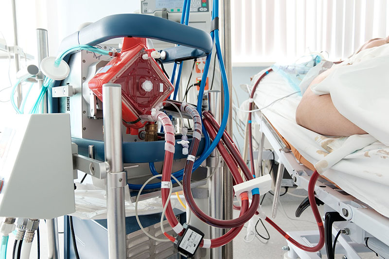Kỹ thuật ECMO cần sử dụng trong cấp cứu bệnh nhân suy hô hấp